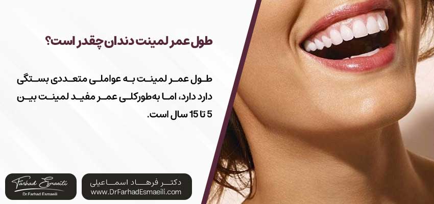 طول عمر لمینت دندان چقدر است؟