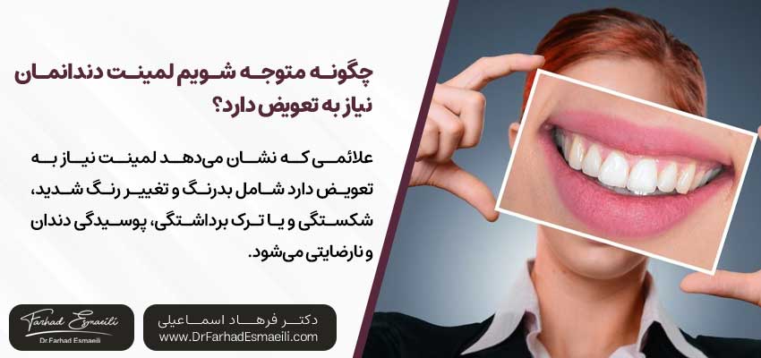 چگونه متوجه شویم لمینت دندانمان نیاز به تعویض دارد؟