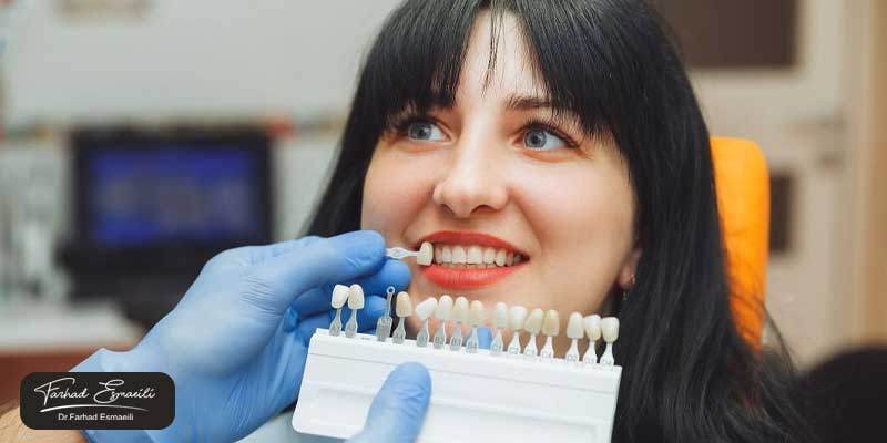 آیا میزان طول عمر در انواع لمینت متفاوت است؟