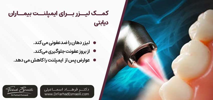کمک لیزر برای ایمپلنت بیماران دیابتی