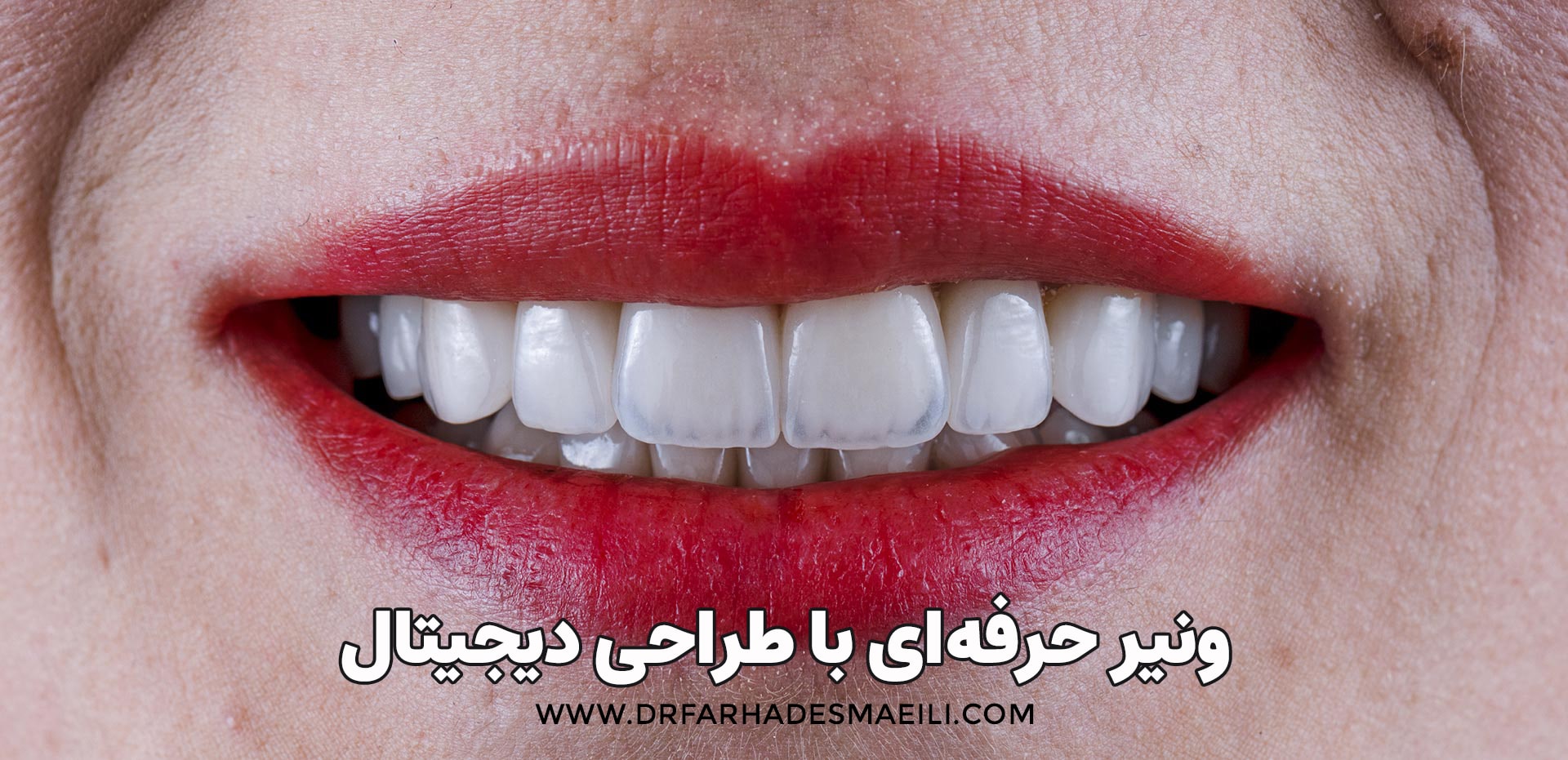 ونیر حرفه ای با طراحی دیجیتال
