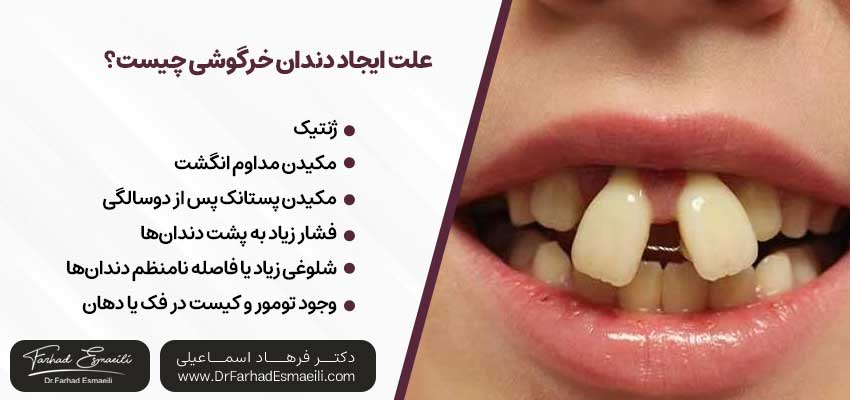علت ایجاد دندان خرگوشی چیست؟