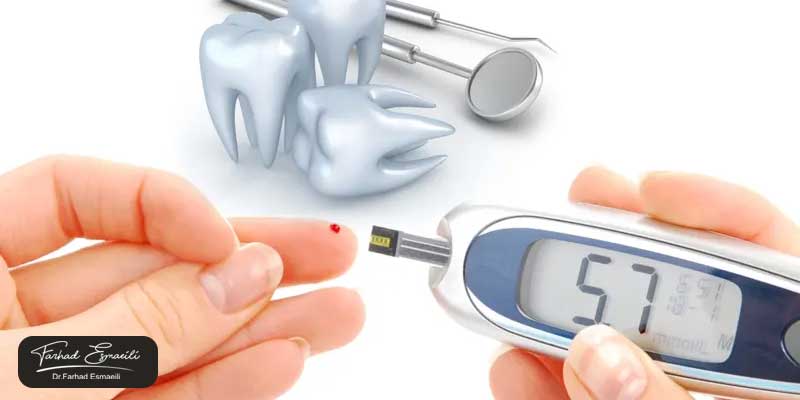 دلیل شکست ایمپلنت بیماران دیابتی چیست؟