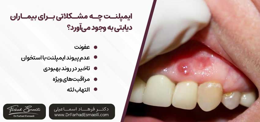 ایمپلنت چه مشکلاتی برای بیماران دیابتی به وجود میآورد؟