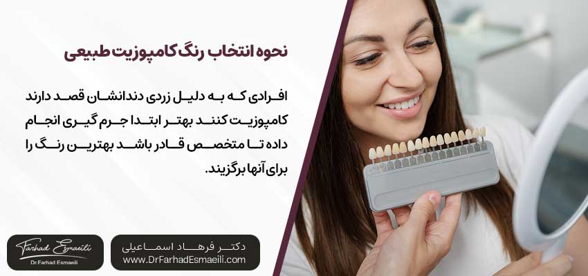 چگونه رنگ کامپوزیت دندان طبیعی انتخاب کنیم؟