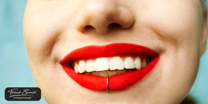 در چه صورتی میتوان از رنگ کامپوزیت دندان سفید یخچالی استفاده کرد؟