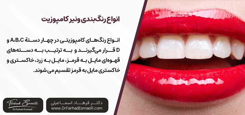 انواع رنگبندی ونیر کامپوزیت در اصفهان