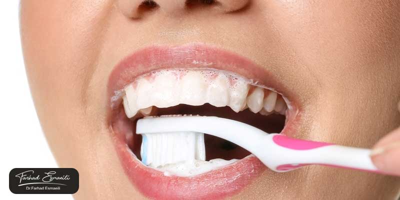 راههای پیشگیری از تغییر رنگ کامپوزیت دندان