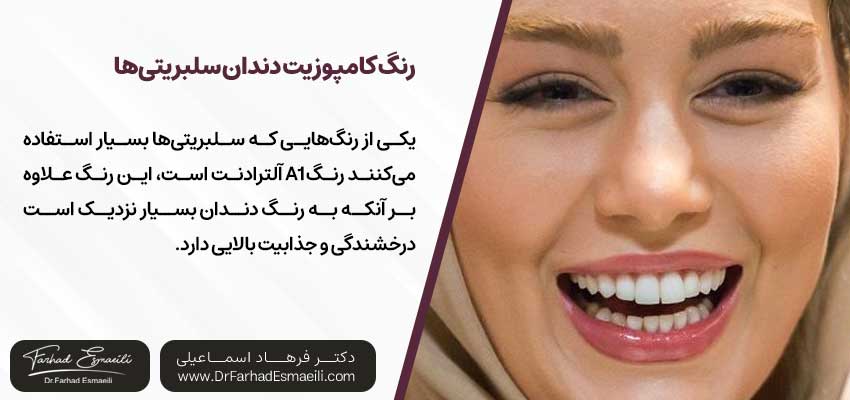 رنگ کامپوزیت دندان سلبریتیها کدام است؟
