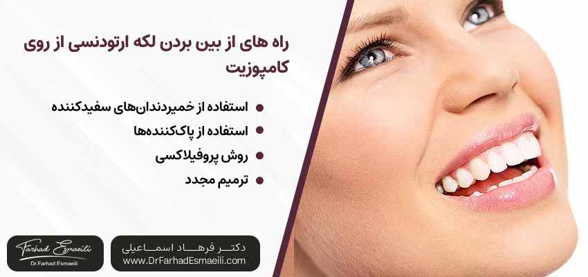 لکههای ایجاد شده روی کامپوزیت بعد از ارتودنسی را چگونه از بین ببریم؟