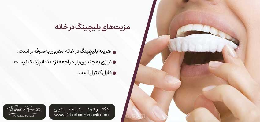 مزیتهای بلیچینگ در خانه