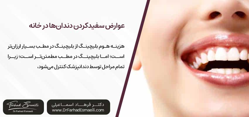 home-bleaching مطمئنتر است یا بلیچینگ در مطب؟