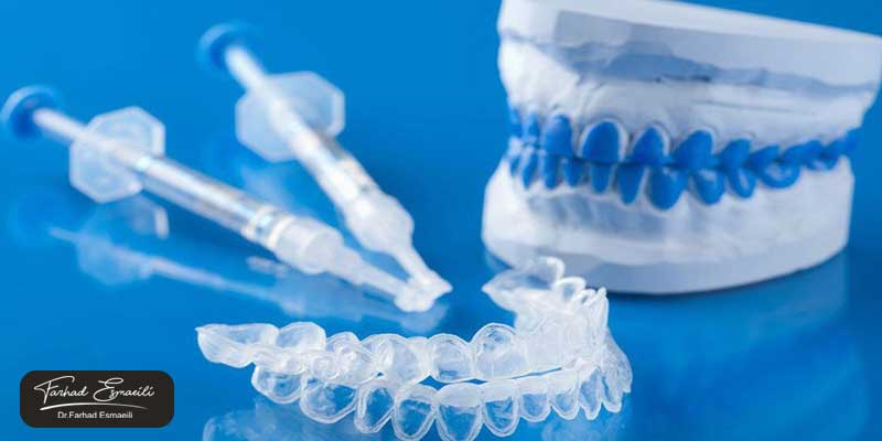 بلیچینگ در خانه چیست؟