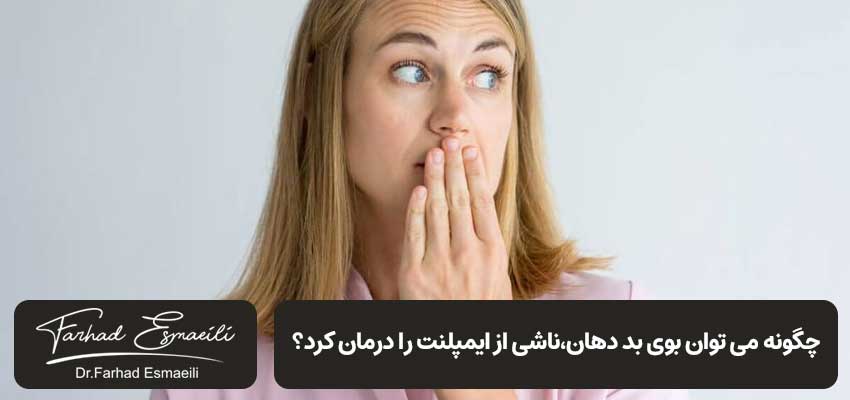 رفع بوی بد دهان بعد از ایمپلنت