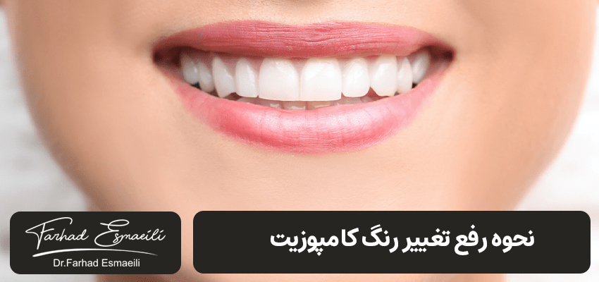 راه های از بین بردن لکه های کامپوزیت