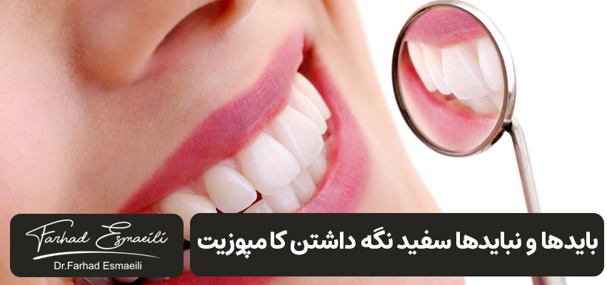 بایدها و نباید های سفید نگه داشتن کامپوزیت