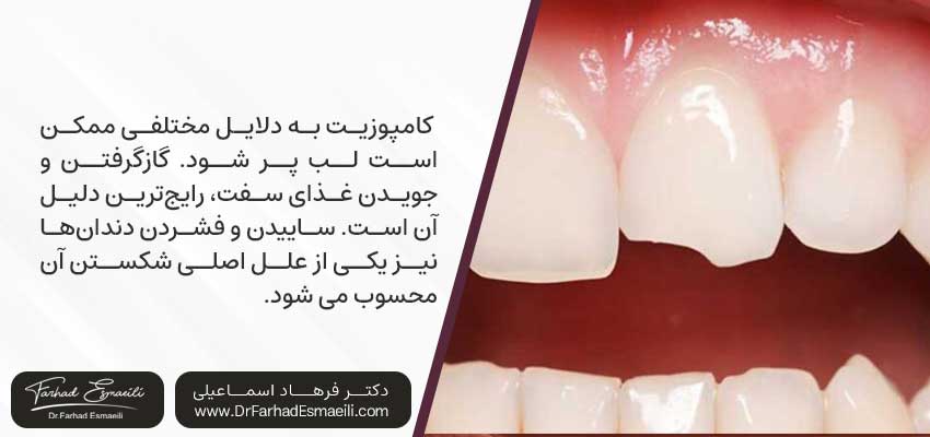 علل شکستن کامپوزیت