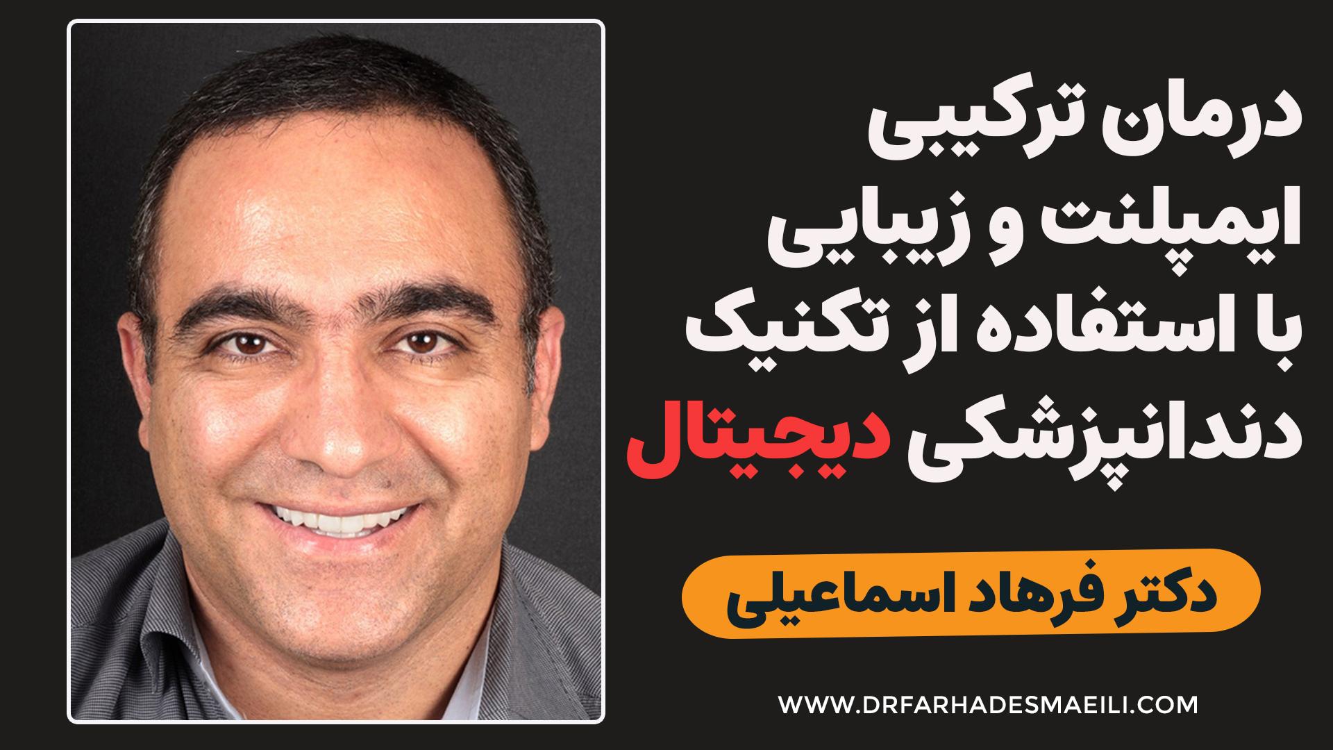 درمان ترکیبی ایمپلنت و زیبایی با استفاده از دندانپزشکی دیجیتال