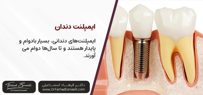 مزایای ایمپلنت دندان | مطب دندان پزشکی دکتر فرهاد اسماعیلی در اصفهان