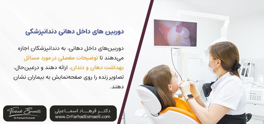مزایای دوربین های داخل دهانی برای کاست ایمپلنت دندان | مطب دندانپزشکی دکتر فرهاد اسماعیلی در اصفهان