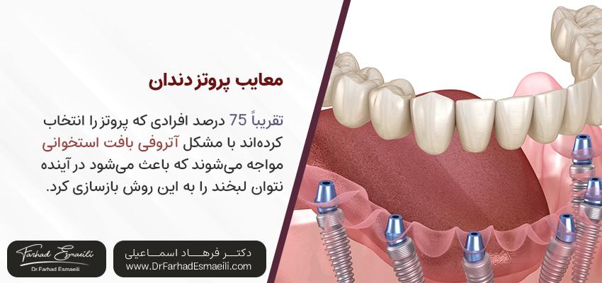 معایب پروتز دندان در مقابل ایمپلنت | مرکز ایمپلنت دیجیتال دکتر فرهاد اسماعیلی