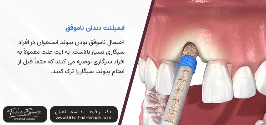پیوند استخوان ناموفق | مرکز ایمپلنت دیجیتال دکتر فرهاد اسماعیلی در اصفهان