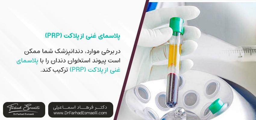 پلاسمای غنی از پلاکت (PRP) برای پیوند استخوان دندان | مطب دندانپزشکی دکتر فرهاد اسماعیلی