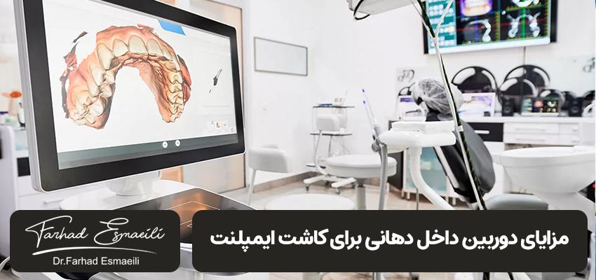 دوربین داخل دهانی برای کاشت ایمپلنت | مرکز ایمپلنت دندان با مدیریت دکتر فرهاد اسماعیلی