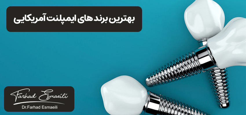 بهترین ایمپلنت آمریکایی دندان | مطب دکتر فرهاد اسماعیلی