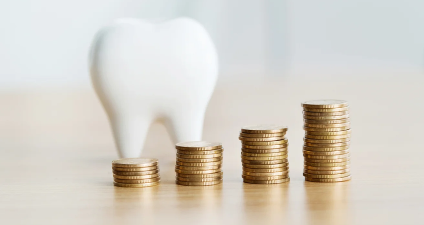 عوامل موثر بر قیمت ایمپلنت دندان | دکتر فرهاد اسماعیلی