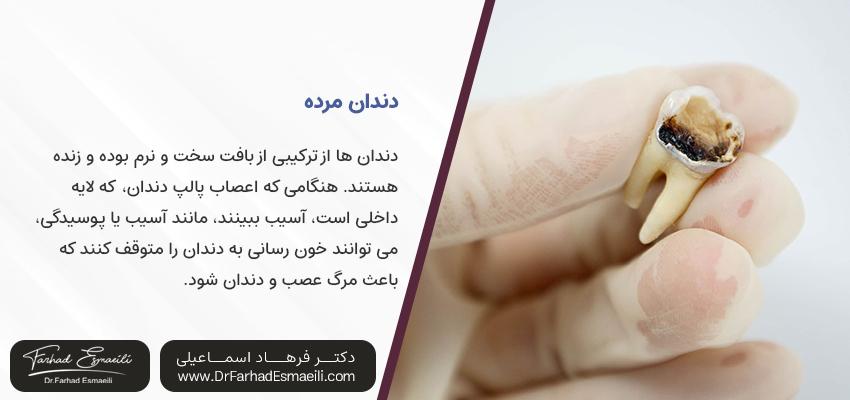 دندان مرده | دکتر فرهاد اسناعیلی متخصص ایمپلنت دیجیتال
