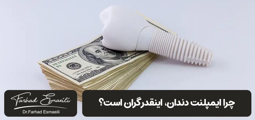 چرا ایمپلنت دندان، اینقدر گران است؟ | مطب ایمپلنت دکتر فرهاد اسماعیلی در اصفهان