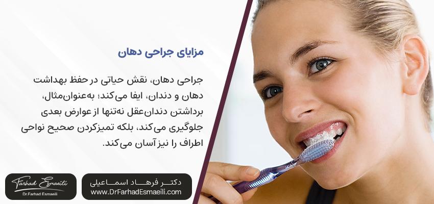 فواید جراحی دهان | بهترین کلینیک ایمپلنت اصفهان
