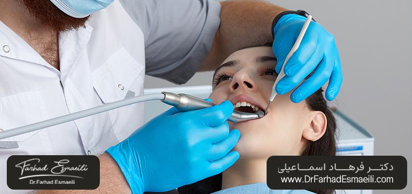 مزایای جراحی دهان | مرکز ایمپلنت دیجیتال دکتر فرهاد اسماعیلی