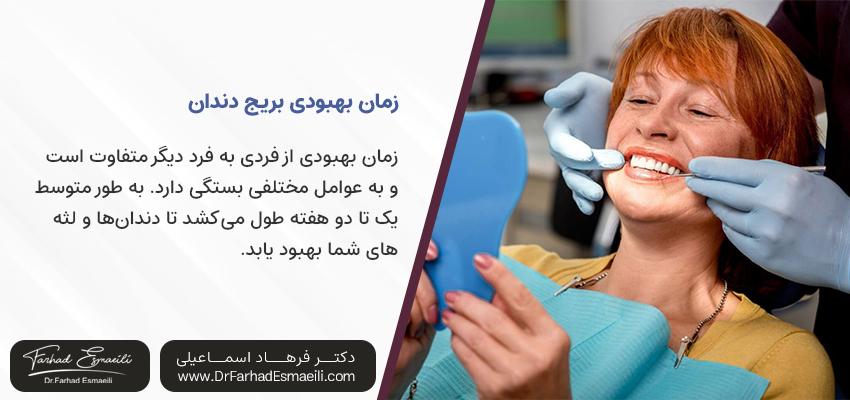 زمان بهبودی بریج دندان | بهترین مرکز ایمپلنت اصفهان