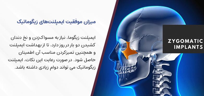 میزان موفقیت ایمپلنت زیگوماتیک | مطب دکتر فرهاد اسماعیلی در اصفهان
