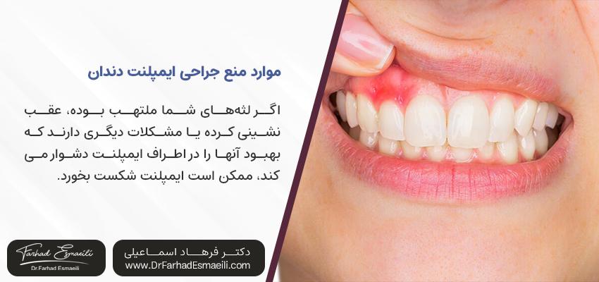 التهاب لثه | موارد منع ایمپلنت دندان
