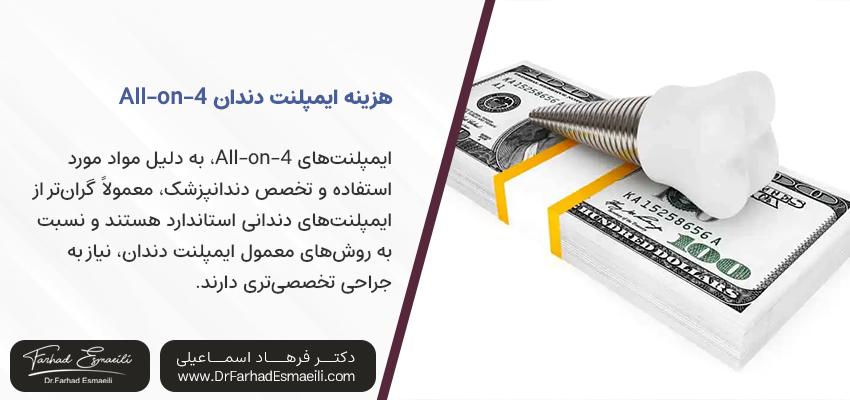 هزینه ایمپلنت دندان All-on-4 | همه چیز درباره ایمپلنت کاشت دندان سریع All-on-4