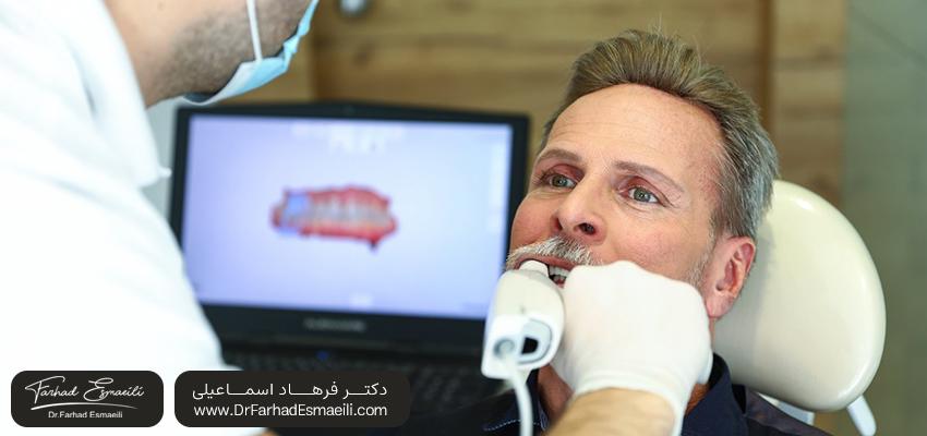 قالب گیری دیجیتال دندان | انواع روش های قالب گیری دندان