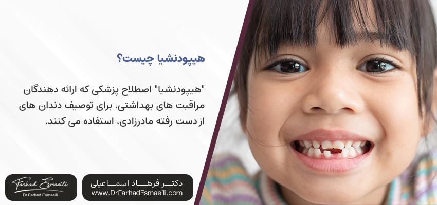 هیپودنشیا چیست؟ | دکتر فرهاد اسماعیلی در اصفهان