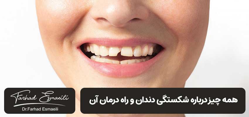 دندان ترک خورده | دکتر فرهاد اسماعیلی