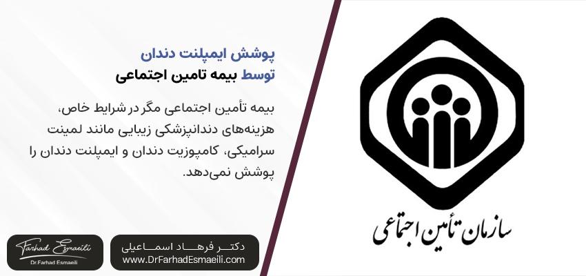پوشش ایمپلنت دندان بیمه تامین اجتماعی | دکتر فرهاد اسماعیلی