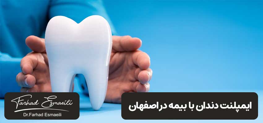 ایمپلنت دندان با بیمه در اصفهان | مرکز ایمپلنت دیجیتال دکتر فرهاد اسماعیلی در اصفهان