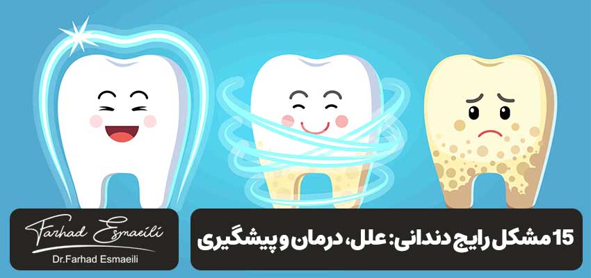 15 مشکل رایج دندانی: علل، درمان، پیشگیری | دکتر فرهاد اسماعیلی
