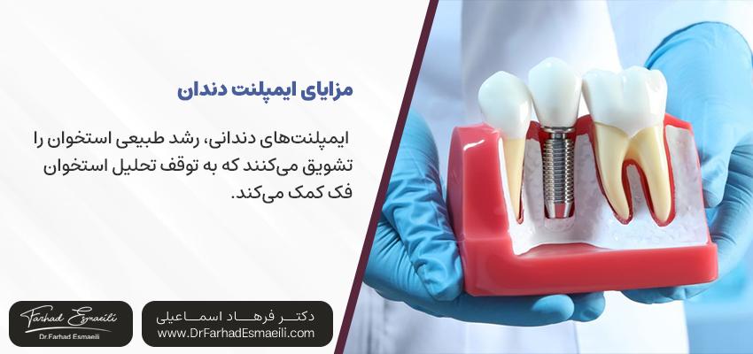 مزایای ایمپلنت دندان | دکتر فرهاد اسماعیلی