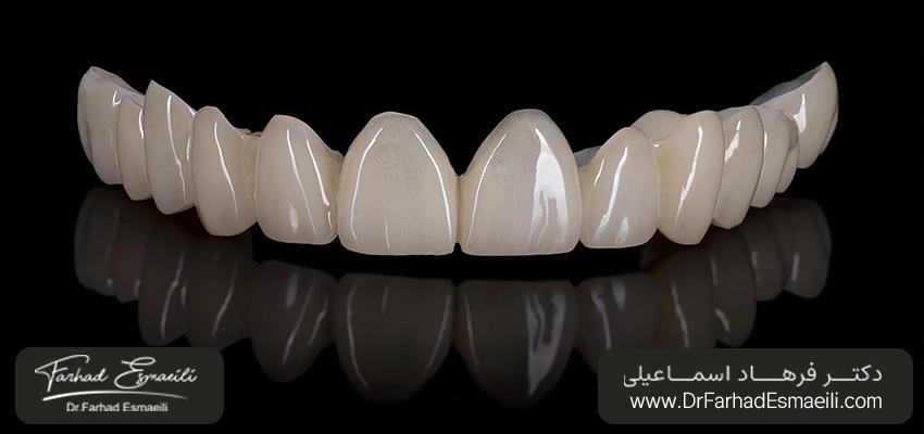 مزایای ایمپلنت زیرکونیا | دکتر فرهاد اسماعیلی 