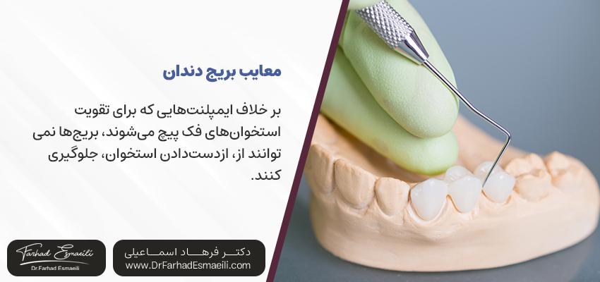 معایب بریج دندان | کلینیک دندانپزشکی دکتر فرهاد اسماعیلی