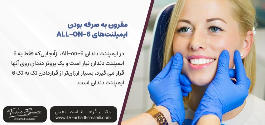 مقرون به صرفه بودن 