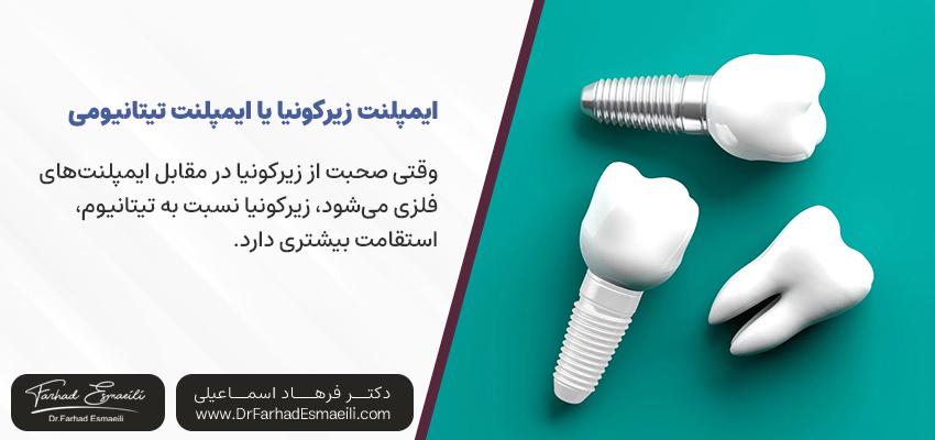 ایمپلنت زیرکونیا در مقابل ایمپلنت تیتانیوم | مرکز ایمپلنت دیجیتال دکتر فرهاد اسماعیلی