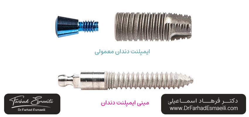مقایسه مینی ایمپلنتها با ایمپلنتهای دندانی معمولی | دکتر فرهاد اسماعیلی